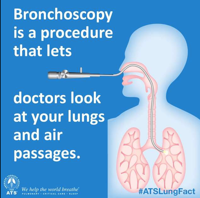 Bronchoscopy procedure by Dr. Sameer Arbat, Nagpur