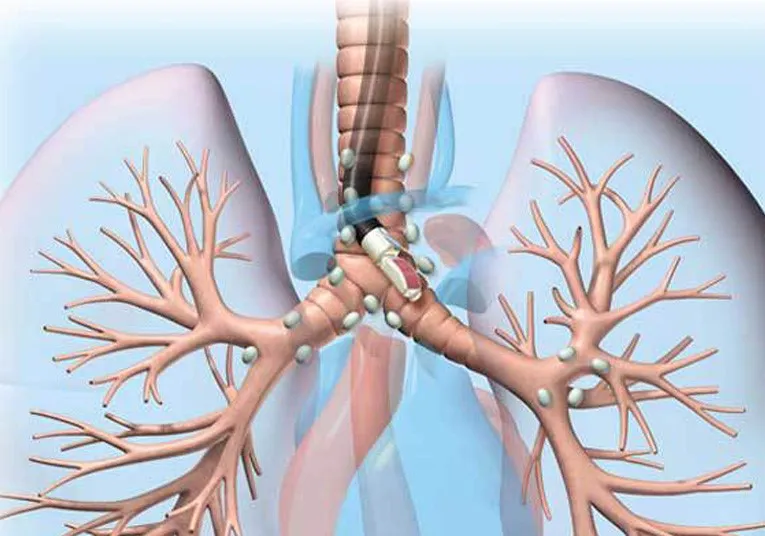 Allergy testing and treatment in Nagpur by Dr. Sameer Arbat