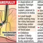 Jowar Seed Stuck in Woman's Lung Airway as Hurda Party Goes Wrong